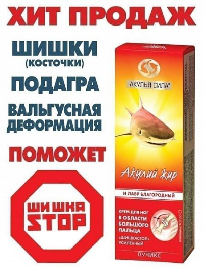 Крем для ног при шишках Акулий жир:uz:Shark yog'i konuslari uchun oyoq kremi