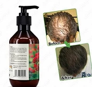 Soch ildizlarini karartma uchun Rapm shampun