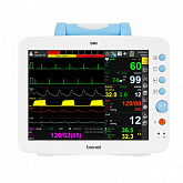 Монитор пациента BM5:uz:BM5 bemor monitori