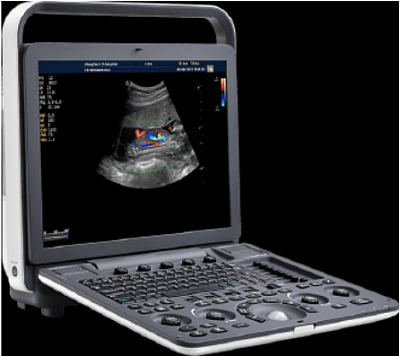 УЗИ портативное  MediSono (США)