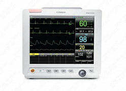To'shak yonidagi bemor monitori STAR8000A (COMEN, Xitoy)