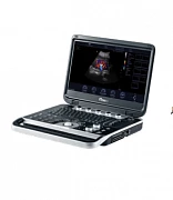 Portativ diagnostika ultratovush apparati Finus 50