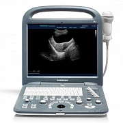Portativ ultratovush apparati S2