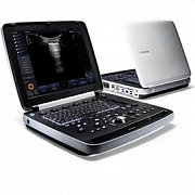 Ultratovush HM70 EVO Samsung