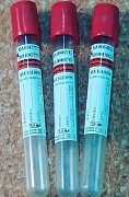 Vakuum trubkasi - ivish faollashtiruvchisi bilan 16*100 9 ml