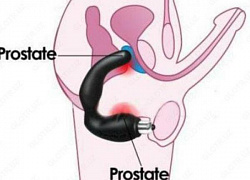 Урологический массажер